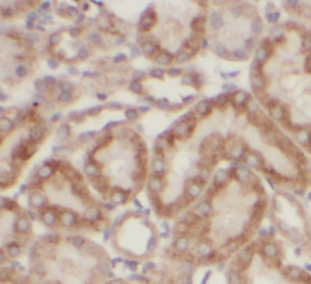 SLC9A8 Rabbit Polyclonal Antibody
