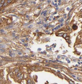 NOMO2 Rabbit Polyclonal Antibody