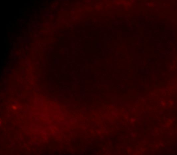 CTAG1A Rabbit Polyclonal Antibody