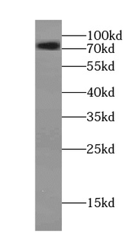 SLC22A5 Antibody