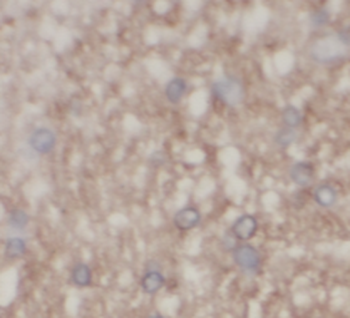 OXA1L Mouse Monoclonal Antibody