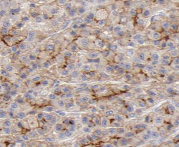 PACS2 Specific Rabbit Polyclonal Antibody