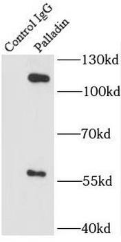 PALLD Specific Rabbit Polyclonal Antibody