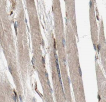PAMR1 Rabbit Polyclonal Antibody