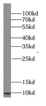 PCP4L1 Rabbit Polyclonal Antibody