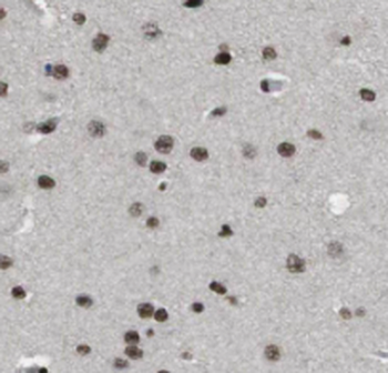 PCP4L1 Rabbit Polyclonal Antibody