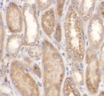 PPARGC1A Rabbit Polyclonal Antibody