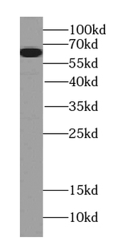 PGM1 Mouse Monoclonal Antibody