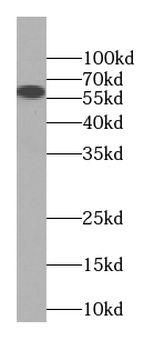 ACCS Rabbit Polyclonal Antibody