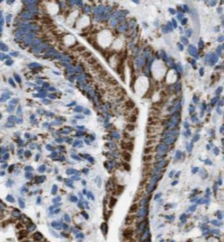 ACCS Rabbit Polyclonal Antibody
