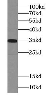 PHOX2B Antibody