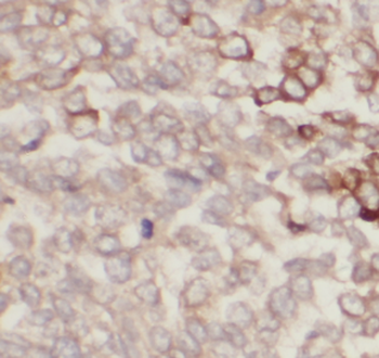 PIK3CB Rabbit Polyclonal Antibody