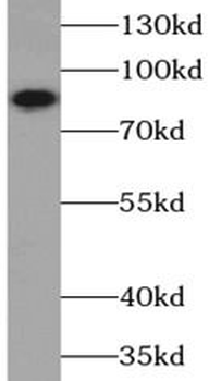 PIK3R1 Antibody