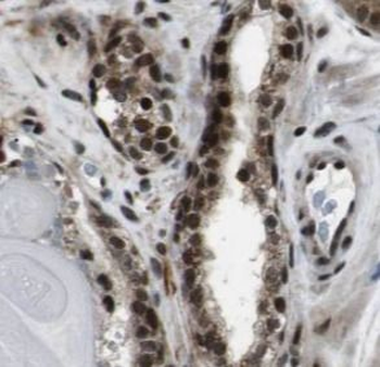 PRKACA Specific Rabbit Polyclonal Antibody