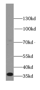 PRKACB specifc Rabbit Polyclonal Antibody