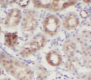 PRKACB specifc Rabbit Polyclonal Antibody