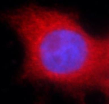 PKM2 specific Rabbit Polyclonal Antibody