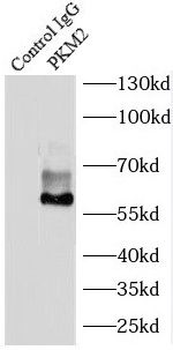 PKM2 specific Rabbit Polyclonal Antibody