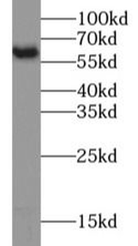 PKM2 Antibody
