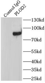 PLOD2 Specific Rabbit Polyclonal Antibody