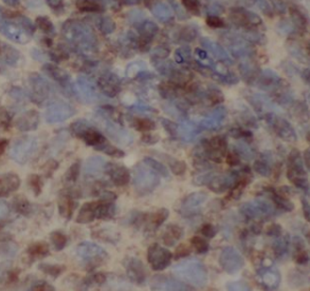 PLOD2 Specific Rabbit Polyclonal Antibody
