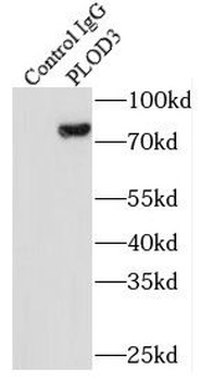 PLOD3 Mouse Monoclonal Antibody