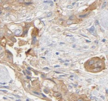 PLOD3 Mouse Monoclonal Antibody