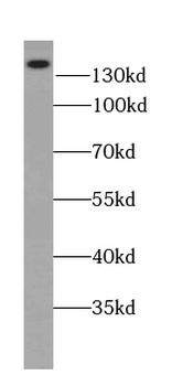 ATP2B2 Antibody