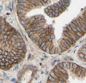 POTED Specific Rabbit Polyclonal Antibody