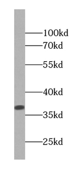 PPP1CB Antibody