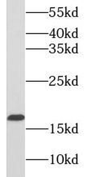 PRDX5 Rabbit Polyclonal Antibody