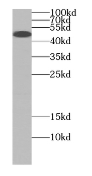 PSMD4 Mouse Monoclonal Antibody