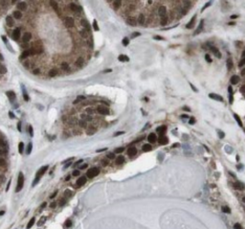 PSMD4 Mouse Monoclonal Antibody
