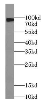 PYGM Antibody