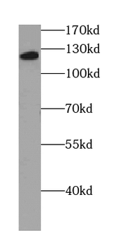 PC Rabbit Polyclonal Antibody