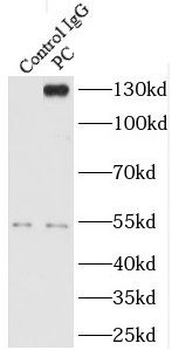 PC Rabbit Polyclonal Antibody