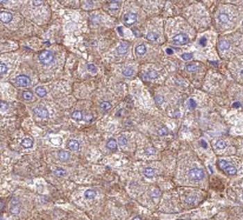 PC Rabbit Polyclonal Antibody