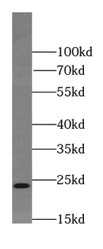 RAB11B Antibody