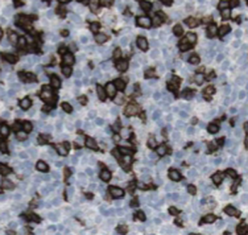 RAB27A Specific Rabbit Polyclonal Antibody