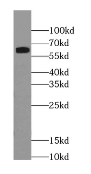 RABEP2 Mouse Monoclonal Antibody