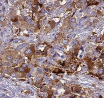 RABEP2 Mouse Monoclonal Antibody