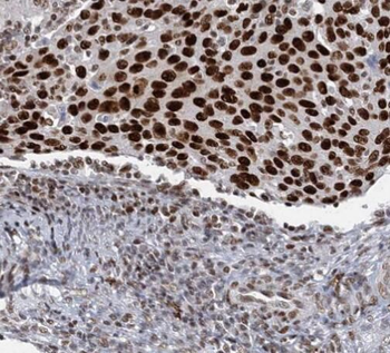 RBBP4 Mouse Monoclonal Antibody