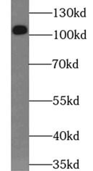 RBM15 Antibody
