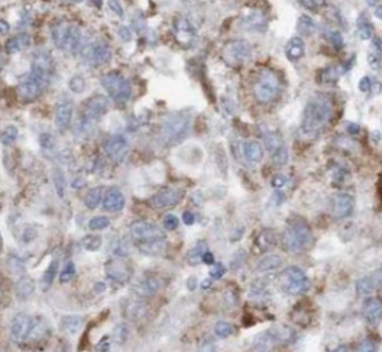 RBM4 Mouse Monoclonal Antibody