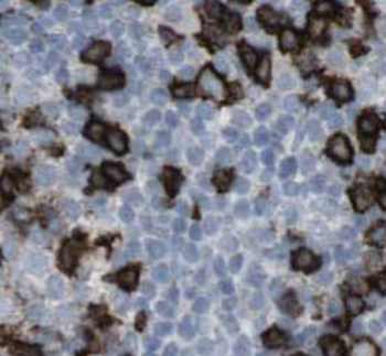 RPL4 Rabbit Polyclonal Antibody