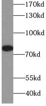 RIPK1 Antibody