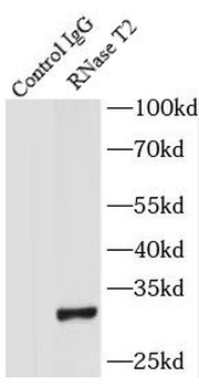 RNASET2 Rabbit Polyclonal Antibody