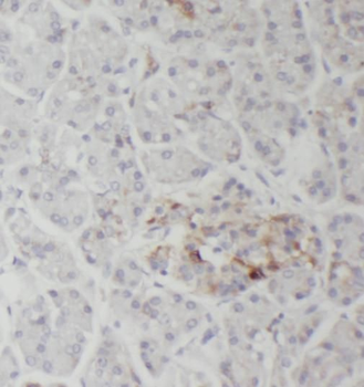 RNASET2 Rabbit Polyclonal Antibody