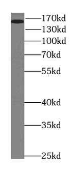 ROCK2 Specific Rabbit Polyclonal Antibody