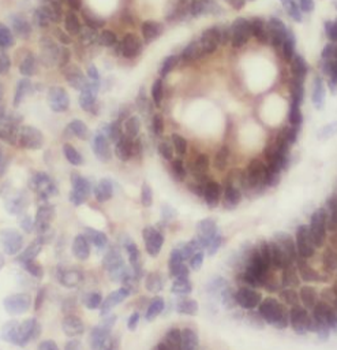 ROCK2 Specific Rabbit Polyclonal Antibody